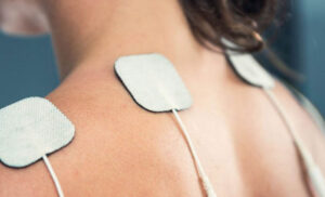TENS-laitteen 50x50mm iho-elektrodit asetettu hartioiden alueen iholle.